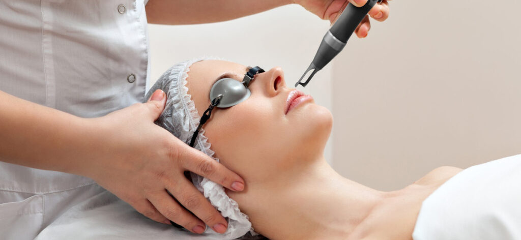 sử dụng laser điều trị nám
