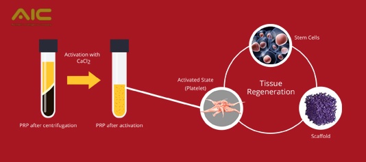 prp và những quan điểm sai lầm