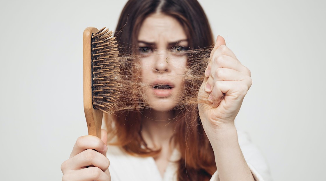 rụng tóc nữa giới