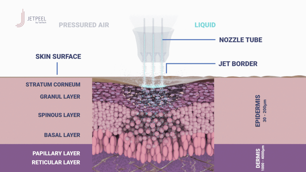 JETPEEL