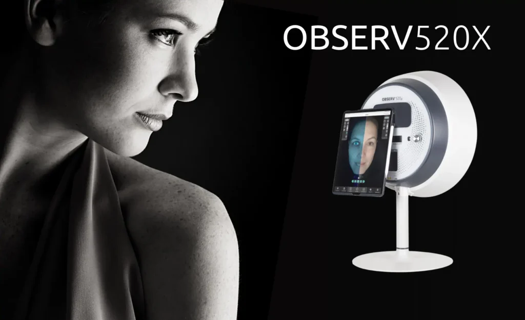 phân tích da Observ