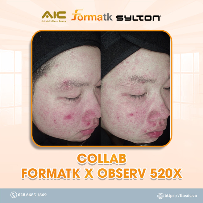 Colab Forma Observ 520x Aic