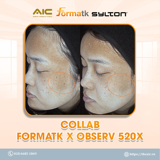 Colab Forma Observ