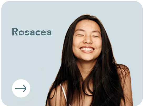 Rosacea Forma Tk