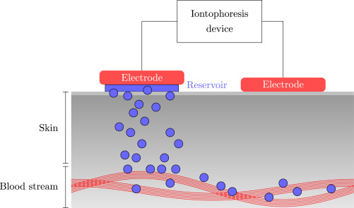 Iontophoresis và Electroporation