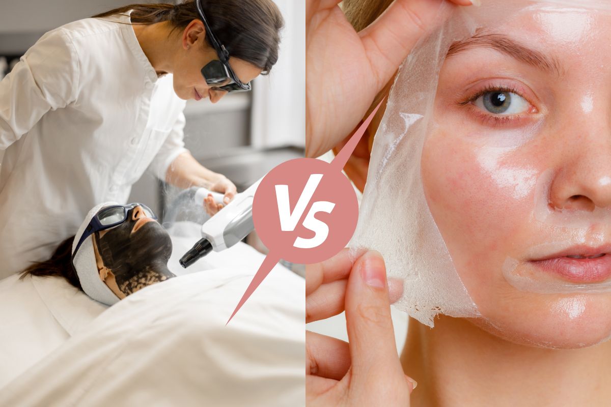 hybrid-peel-vs-laser