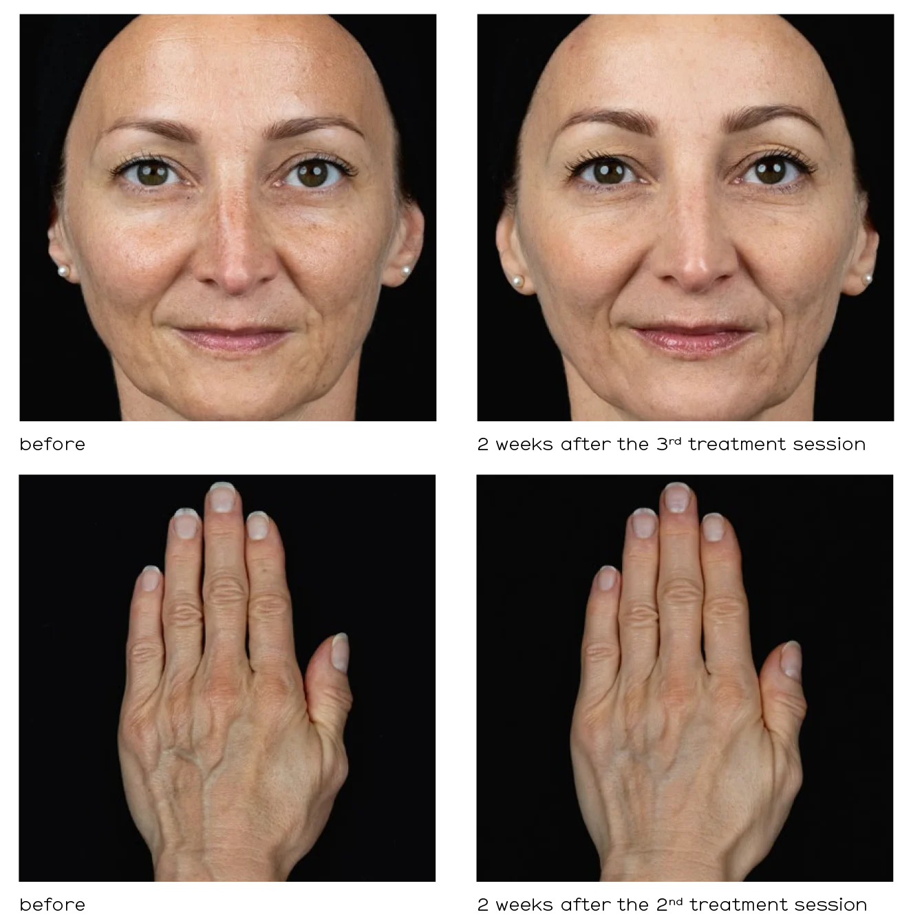 skin priming