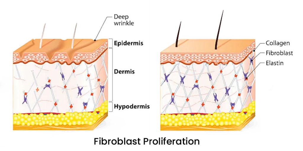 Pn-HPT